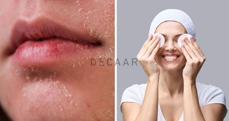 Tại sao cần cân nhắc việc sử dụng toner sau peel da?